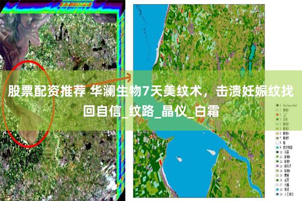 股票配资推荐 华澜生物7天美纹术，击溃妊娠纹找回自信_纹路_晶仪_白霜